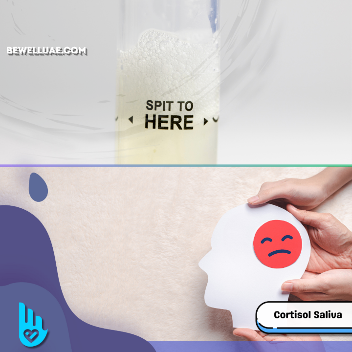 Cortisol Adrenal Stress Test