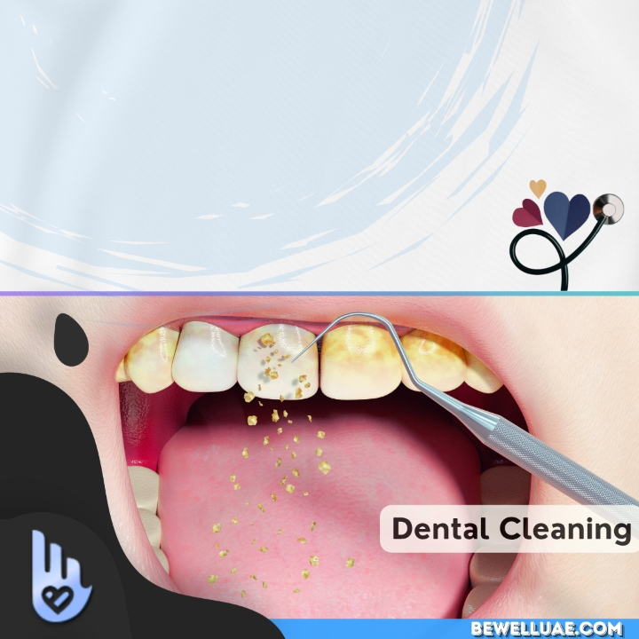 Teeth Cleaning and whitening 