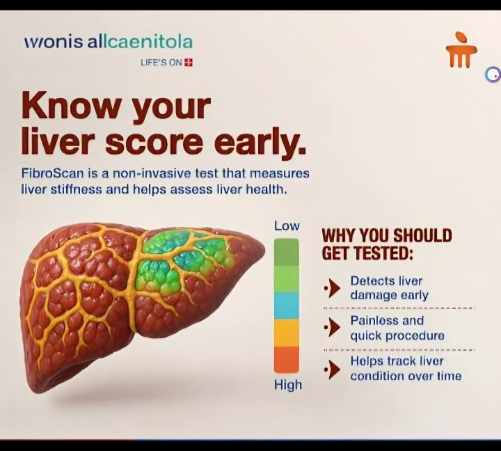 Image of Fibroscan 