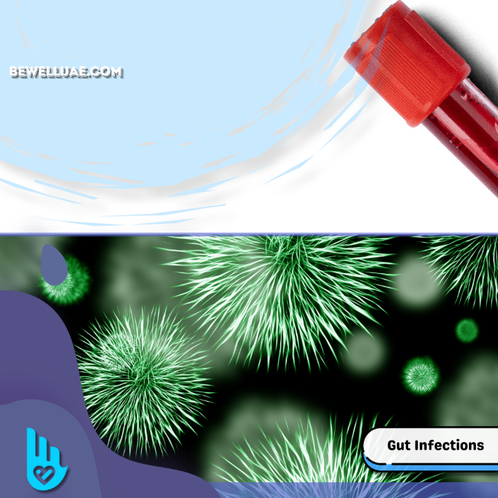 Gut Infection Panel 19