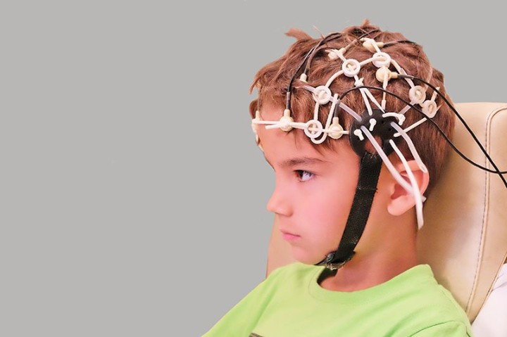 Image of EEG monitoring