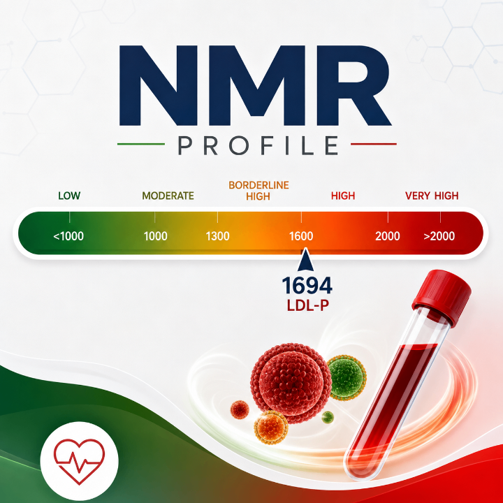 فحص NMR