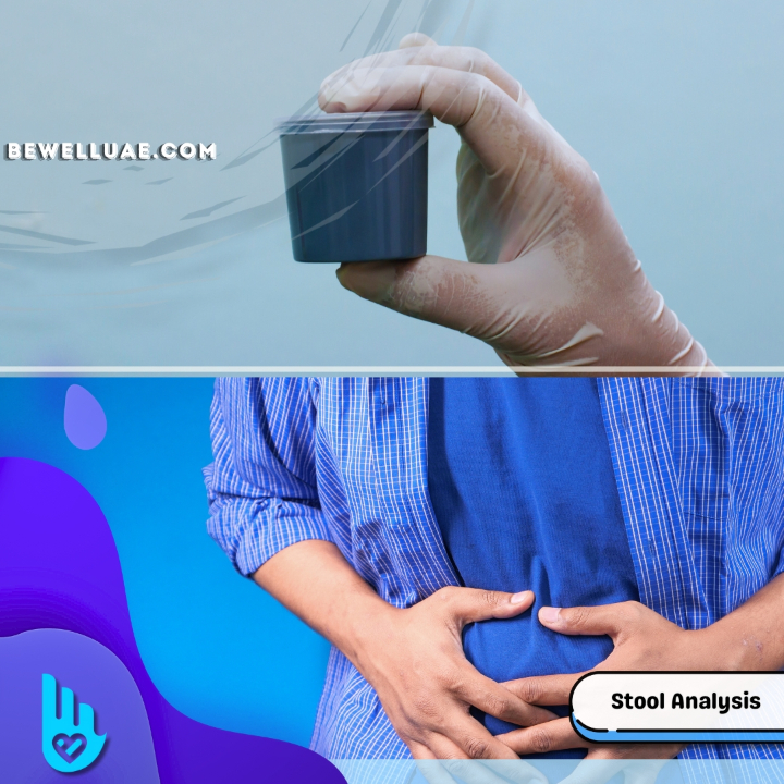 Stool Analysis Coprogram