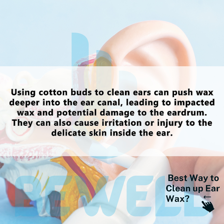 Image of Ear wax Removal