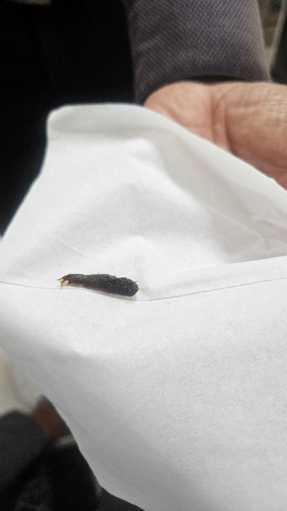 Image of Ear wax Removal