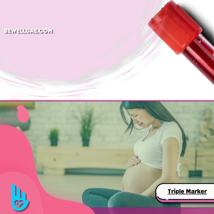 Triple Marker (Pregnancy)